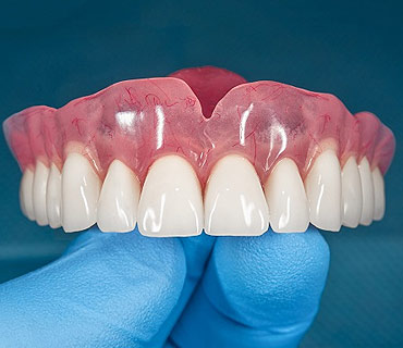 Dentures/Denture